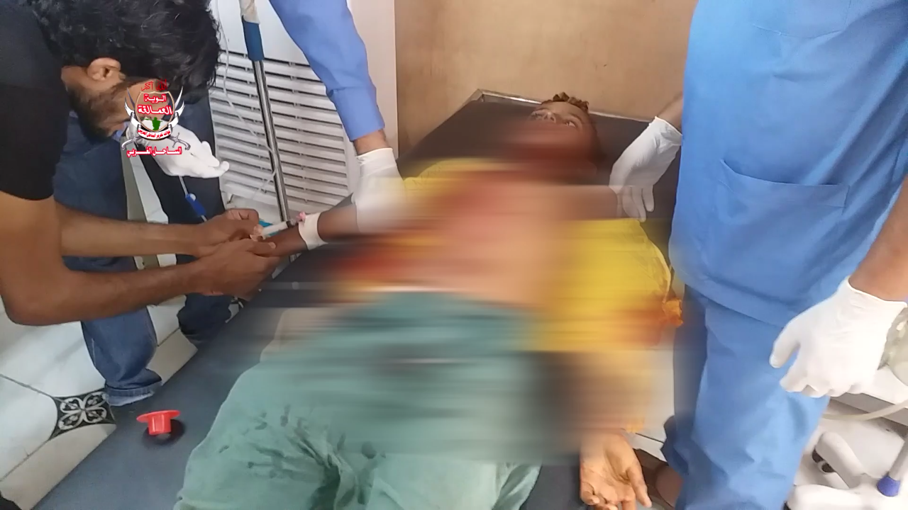 الحديدة..إصابة طفلين بانفجار لغم زرعته المليشيات الحوثية في الدريهمي