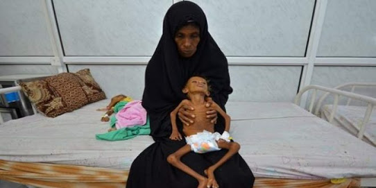 امرأة وستة من حديثي الولادة يموتون كل ساعتين في اليمن