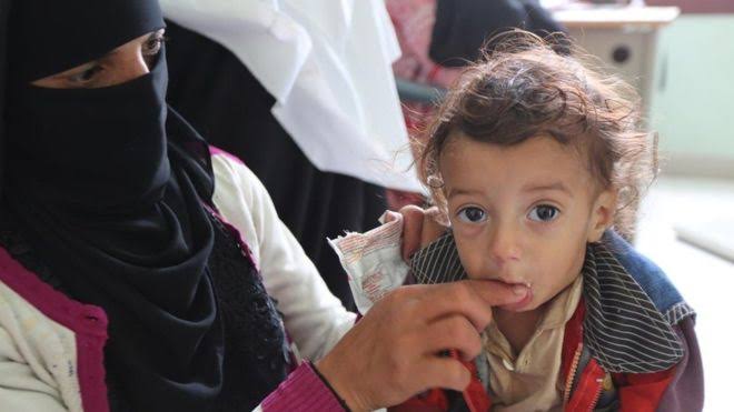 منظمة أممية: اليمن من أسوأ البلدان للأطفال في العالم