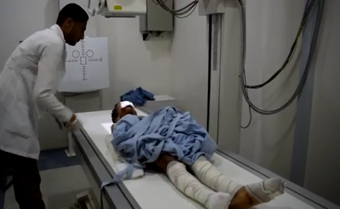 إصابة طفل بقذيفة حوثية بالغيل في الجوف