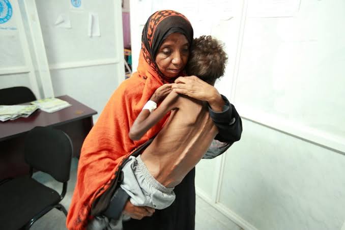 الأمم المتحدة تحذر من حدوث مجاعة قريبة في اليمن