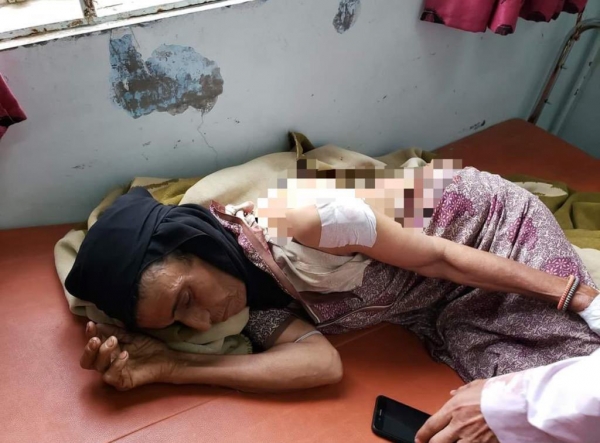 إصابة 4 مدنيين بينهم امرأة وطفلان بنيران مليشيا الحوثي في تعز